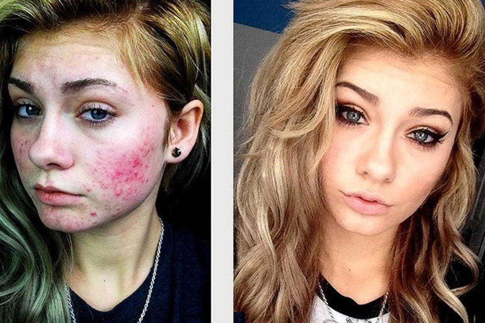 Kaputte Zahne Vorher Nachher Bilder