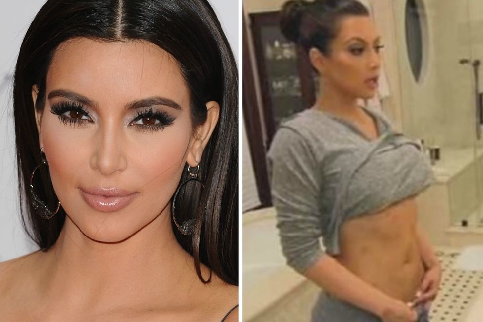 Kim Kardashian schockt Fans mit Krankheits-Geständnis