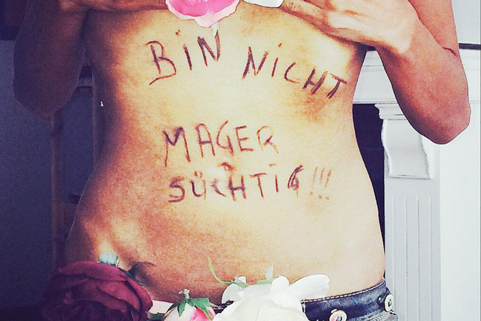 „Ich bin nicht magersüchtig“