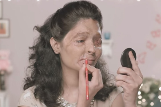 Frau zeigt sich nach Säureanschlag in Beauty-Tutorials Frau zeigt sich nach Säureanschlag in Beauty-Tutorials