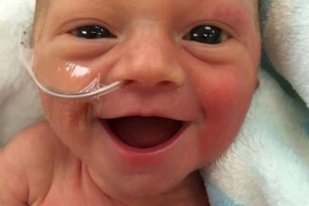 Warum dieses lächelnde Baby so vielen Eltern Mut gibt