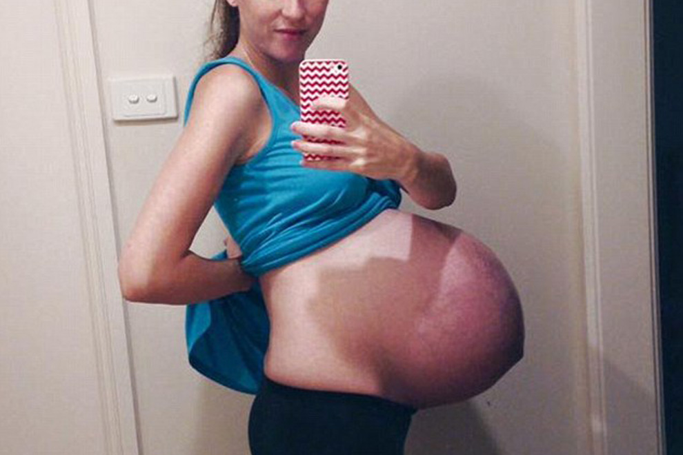 Schwangere postet Babybauch – mit schlimmen Folgen.