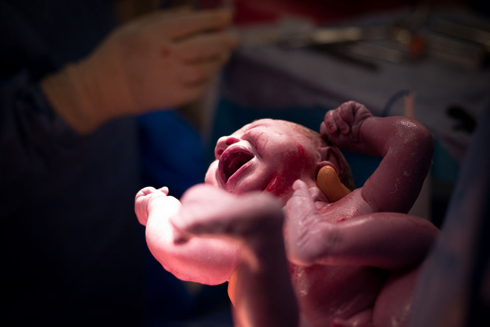 35. Woche: Baby tritt Loch in die Gebärmutter seiner Mutter