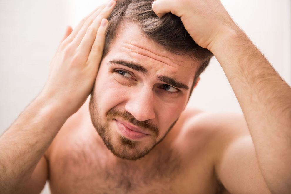 Männer mit diesem Merkmal neigen eher zu Haarausfall