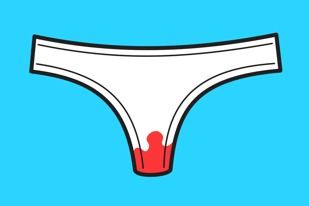 Was sagt die Farbe meines Menstruationsblutes aus?