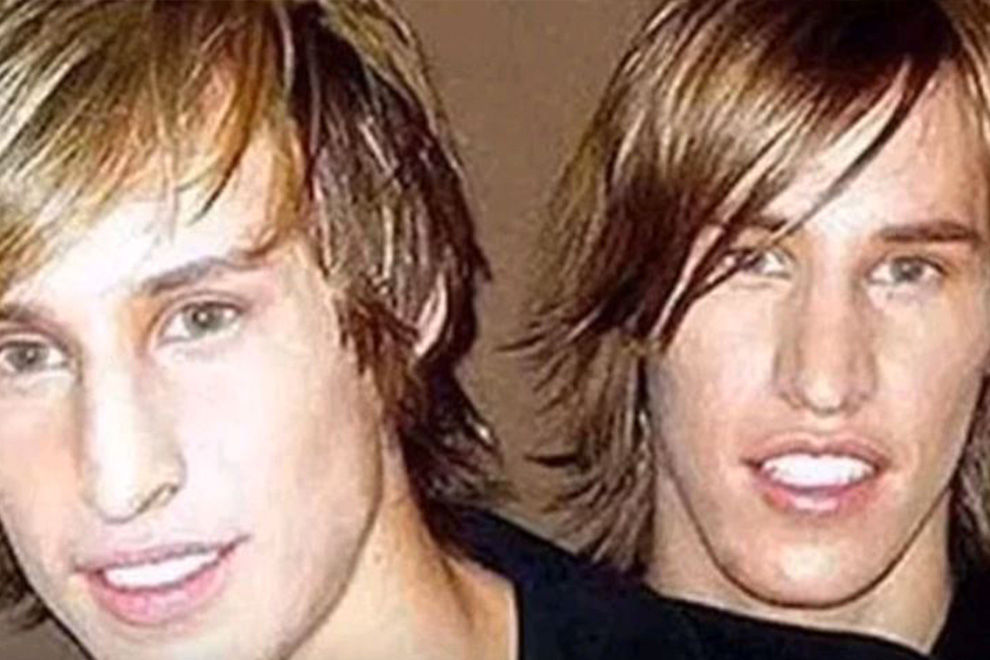 Zwillingsbrüder lassen sich zu Brad Pitt umoperieren