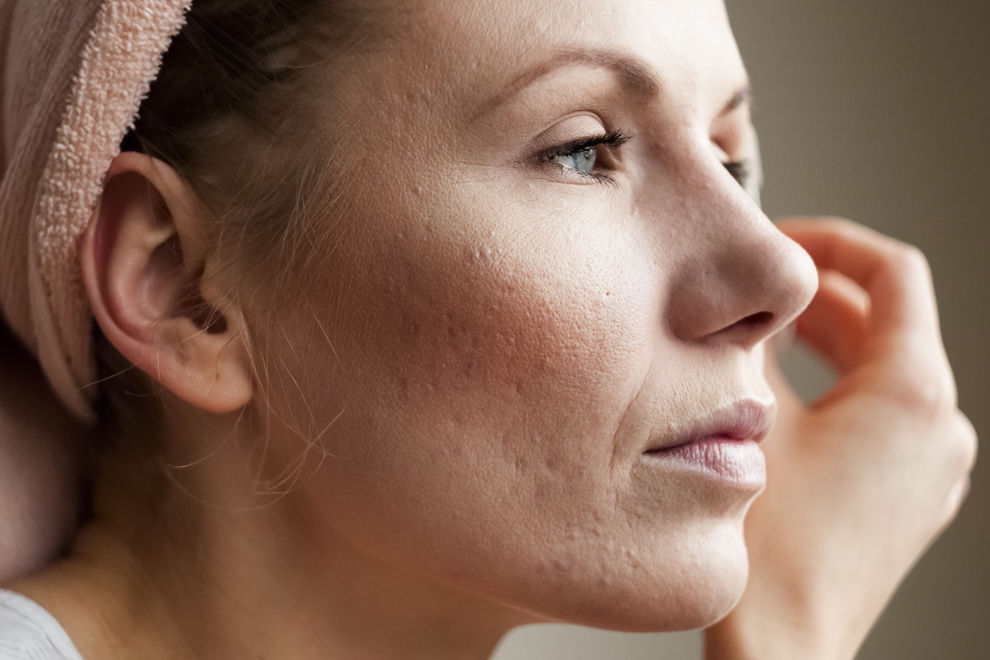 Das kann passieren, wenn du zu viel Make-up trägst