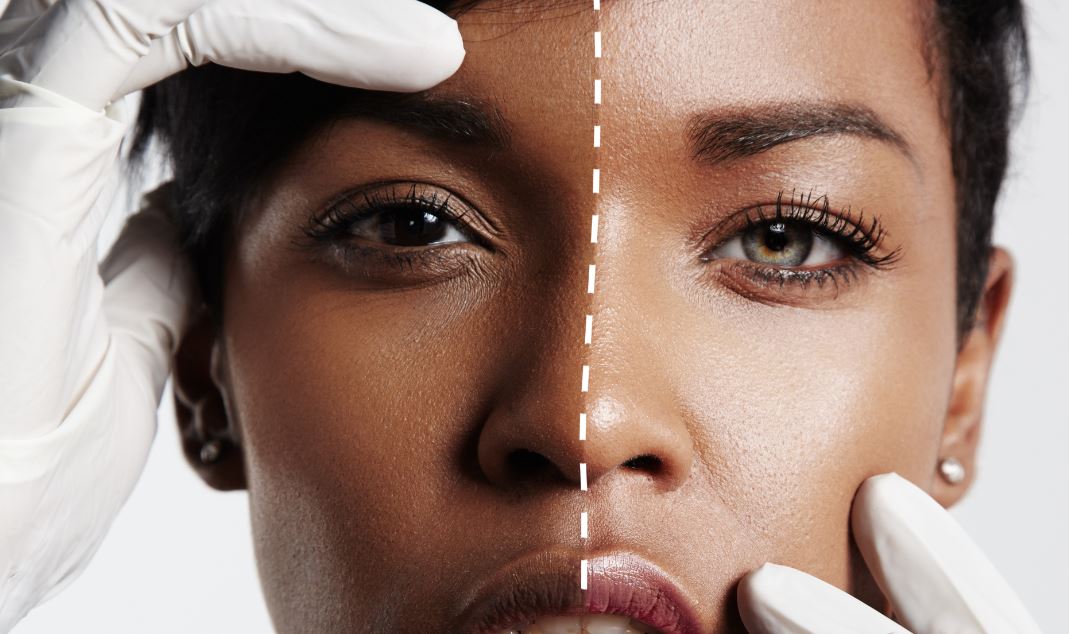 SkinBleaching Wie gefährlich der Trend wirklich ist