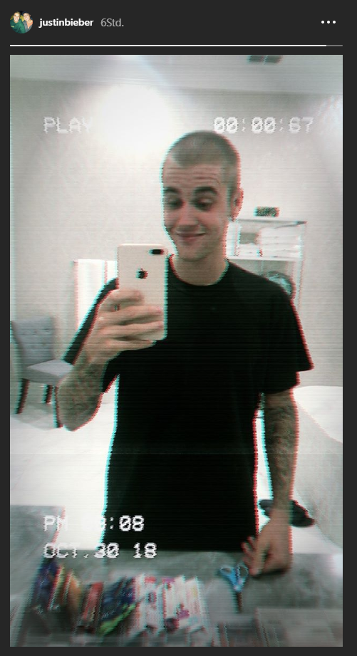 Justin Bieber hat sich seine Haare abrasiert 