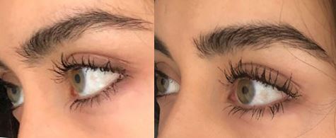 Lashlift Profil