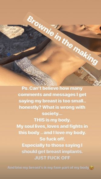 Stefanie Giesinger wehrt sich gegen Bodyshaming via Instagram