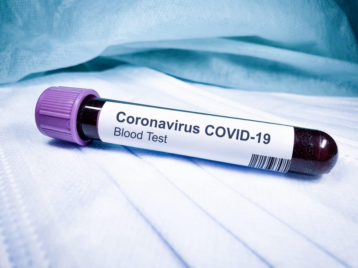 Über 3000 Coronavirus-Infektionen in Österreich