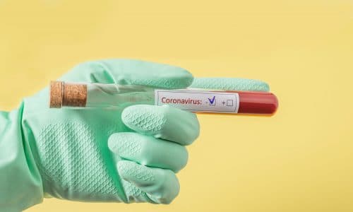Coronavirus Online Selbsttest: So kannst du dein Erkrankungsrisiko testen