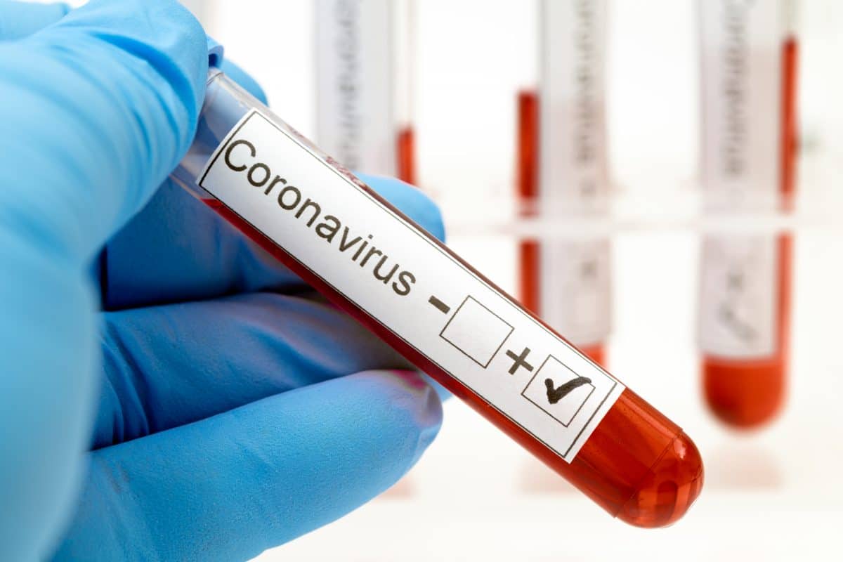 Coronavirus: Weltweit mehr als drei Millionen Infizierte