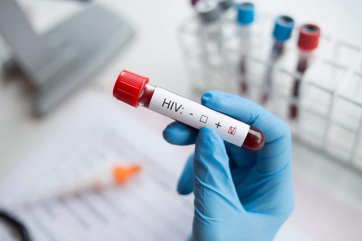 Weltweit zweiter HIV-Patient „geheilt“: Immer noch virenfrei