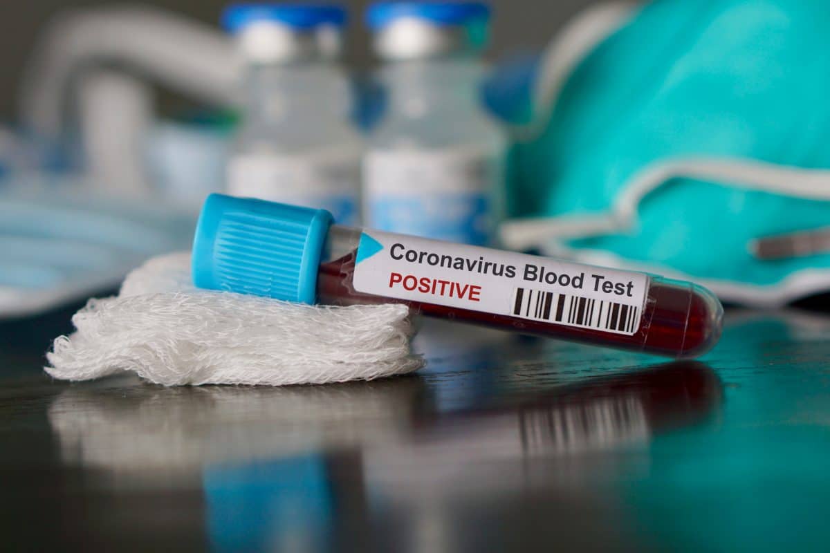 Coronavirus: Weltweit mehr als 3,5 Millionen Infizierte