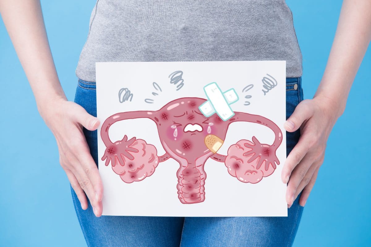 #endosisters: Instagram-Bewegung klärt über Endometriose auf