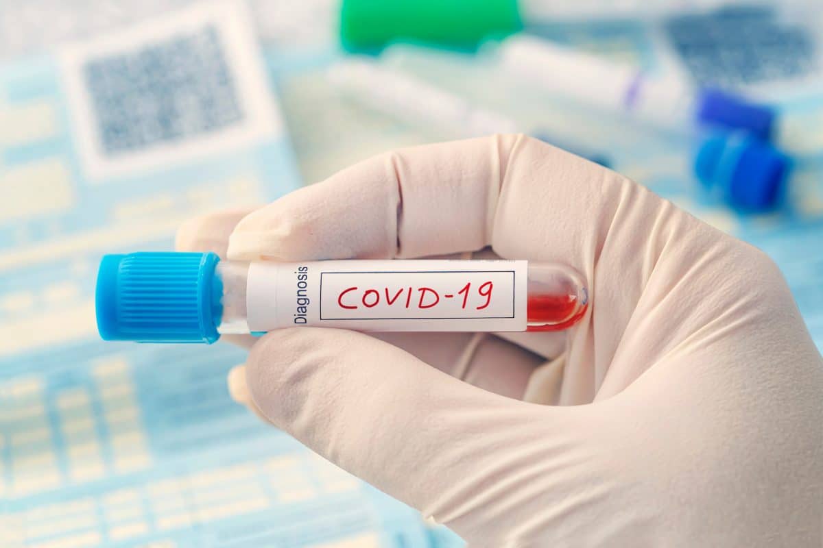 Experten warnen vor Delta-Variante des Coronavirus