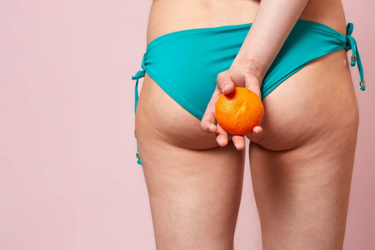 Ciao Cellulite! Nützliche Expertentipps für straffe Haut