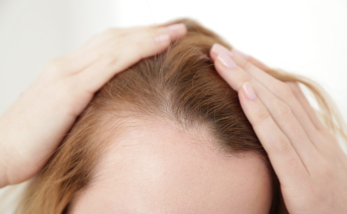 Haarausfall: Was hilft wirklich gegen Haarverlust?