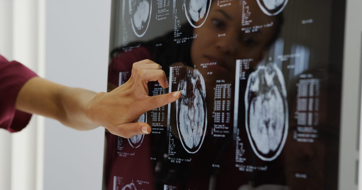 China: Ärzte finden Fötus im Gehirn von einjährigem Mädchen